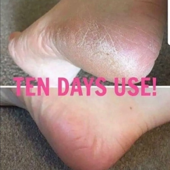 (1) Epoch Foot Treatment Sole solution - Picture 5 of 8